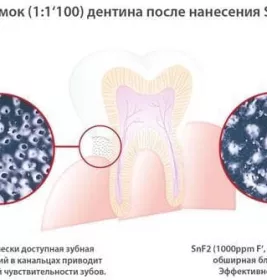 *Ополаскиватель Dr. Wild Emofluor для полости рта 250мл
