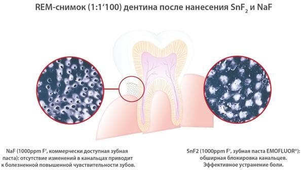 *Ополіскувач Dr. Wild Emofluor для ротової порожнини 250мл