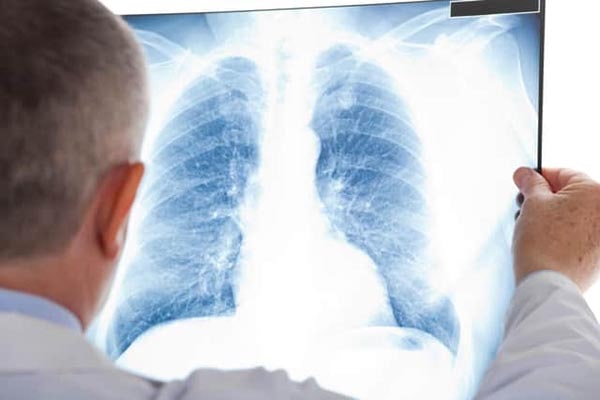 Як проявляється хвороба?